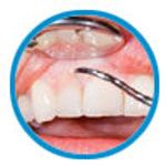 Periodontists / Gum Disease