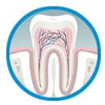 Root Canal Treatment / Endodontics